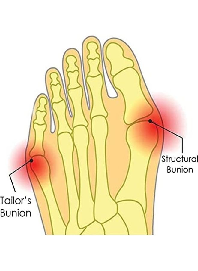 2-Piece Bunion Corrector With Non-slip Grip Insert And Gel Cushion Pad