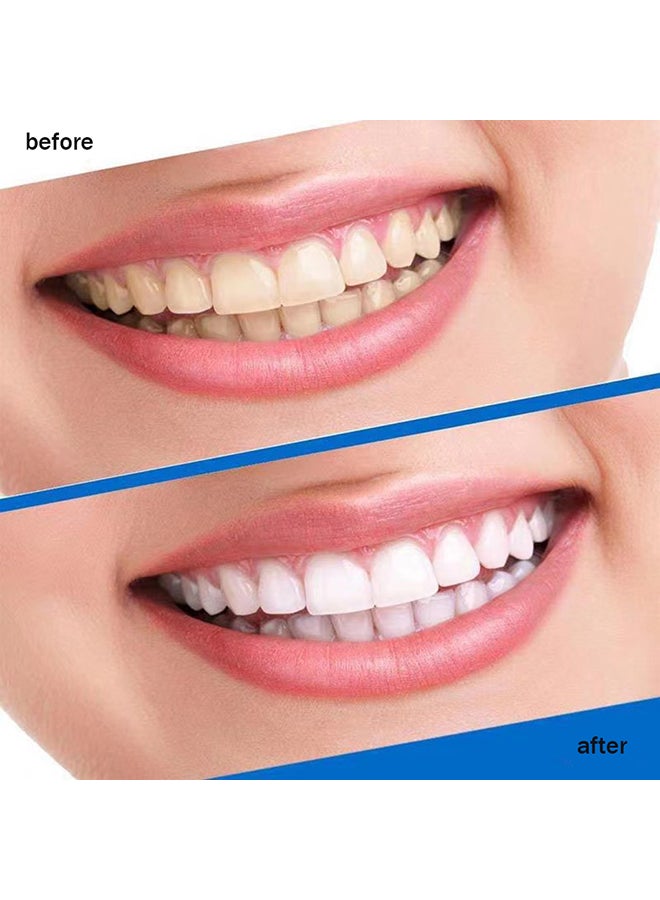 VILILY 3-Box 3D White Glamorous Dental Whitening Kit 42 Strips Clear 11.7 x 6.6 x 1.7cm - Image 3