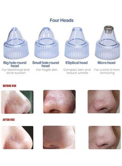 Beautystar 4 in 1 Blackhead Remover Pink 250grams  - Image 3