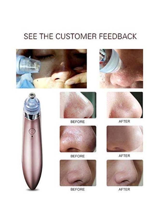 مزيل حب الشباب والرؤوس السوداء قابل للشحن ذهبي وردي - Image 2