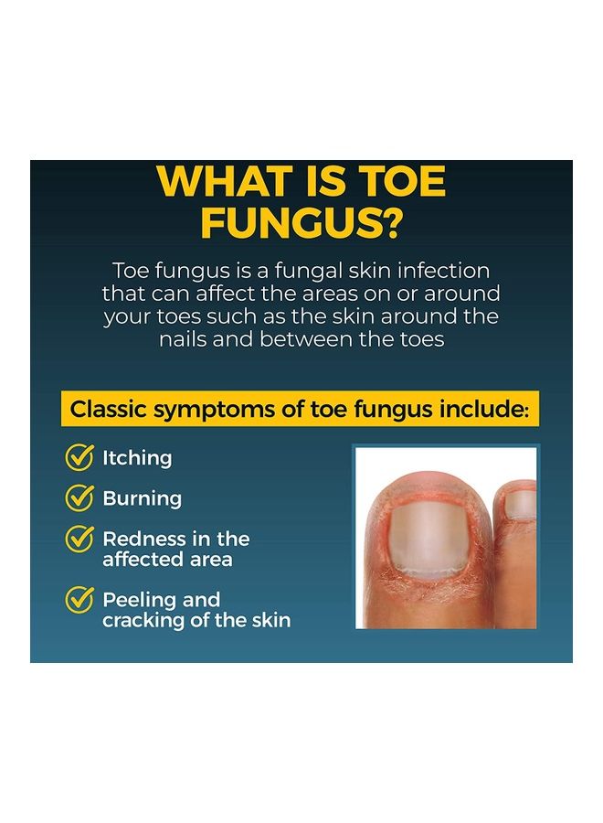 فانغي-نيل محلول سائل مضاد للفطريات - Image 5