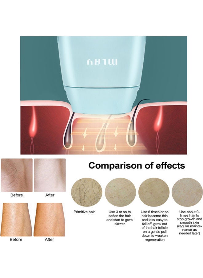 ملاي جهاز إزالة الشعر الدائم بالليزر في المنزل بتقنية IPL أخضر - Image 5