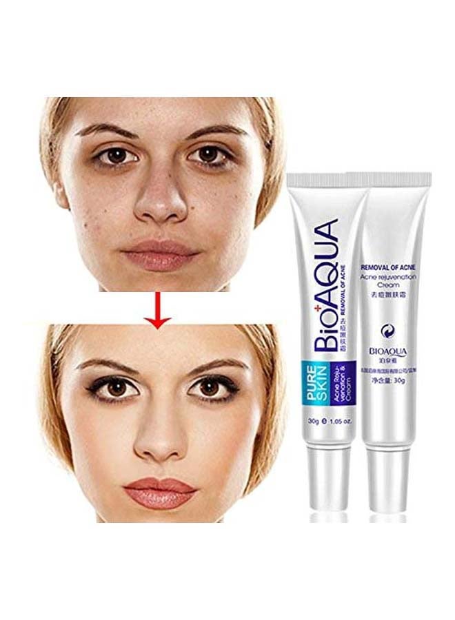 Anti Acne Scar Mark Treatment Cream 30grams - v1638710266/N29328180A_3