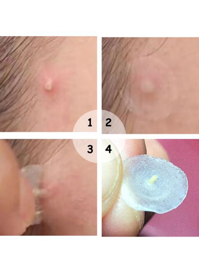 Breylee - Invisible Acne Pimple Patch Clear - Image 1
