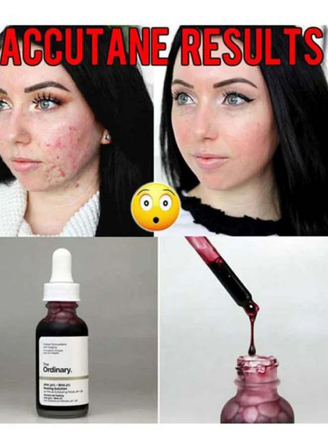 The Ordinary 2-Piece Peeling Solution And Niacinamide 10% Zinc 1% Serum 30ml