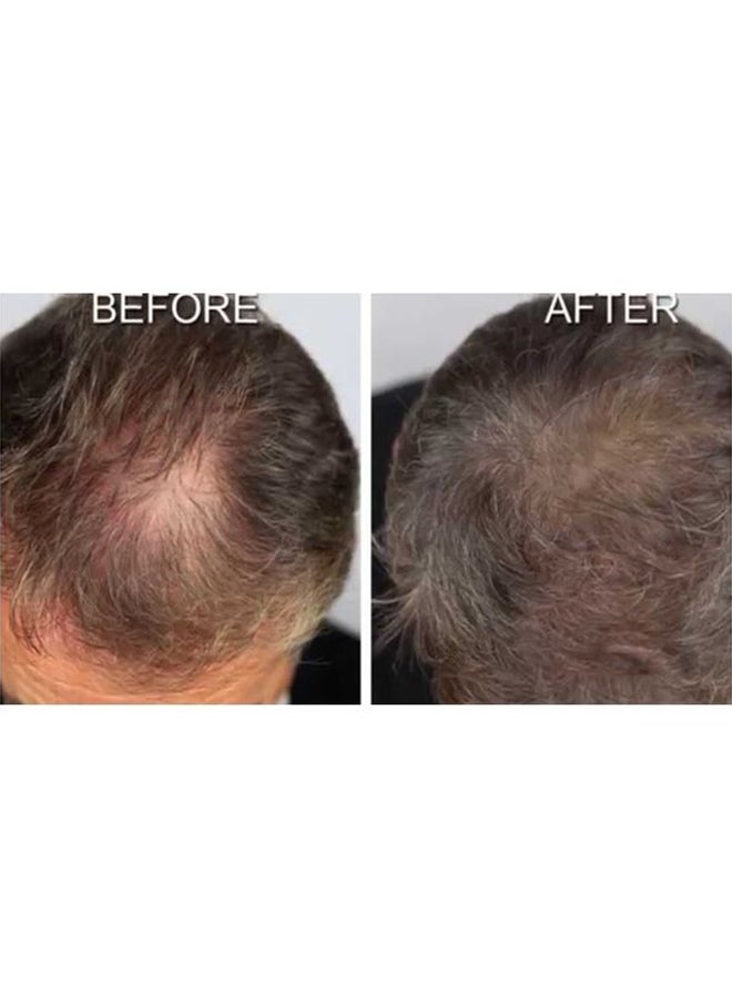 New Nordic Hair Gro Hairgrowth Support Tablets - Image 5