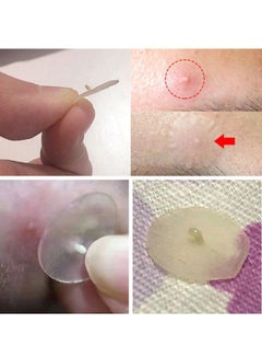 Breylee Invisible Acne Pimple Patch Clear  - Image 2