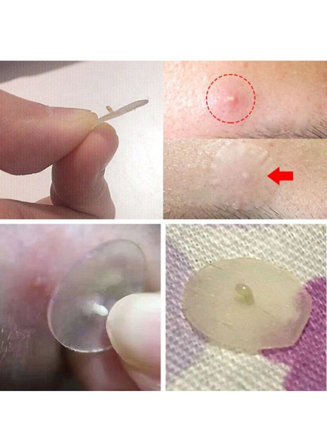 Breylee - Invisible Acne Pimple Patch Clear - Image 1