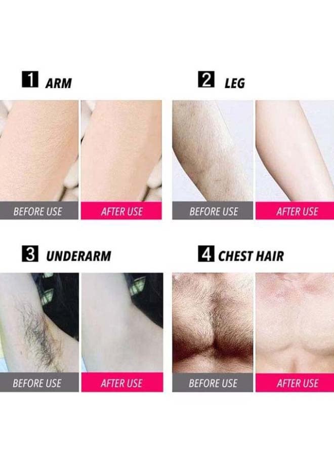Generic Mini Handheld Facial Permanent Hair Removal Laser Machine Rose Gold  - Image 3