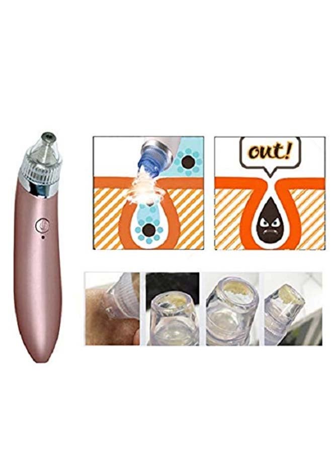 Sharpdo Electric Vacuum Blackhead And Acne Remover Rose Gold 10cm - Image 3