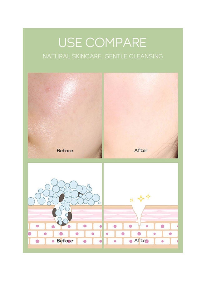 فيني مجموعة ماسكات طمي بخلاصة الشاي للتنظيف اللطيف والتحكم في دهون البشرة من 20 قطعة أخضر 100جرام - Image 5