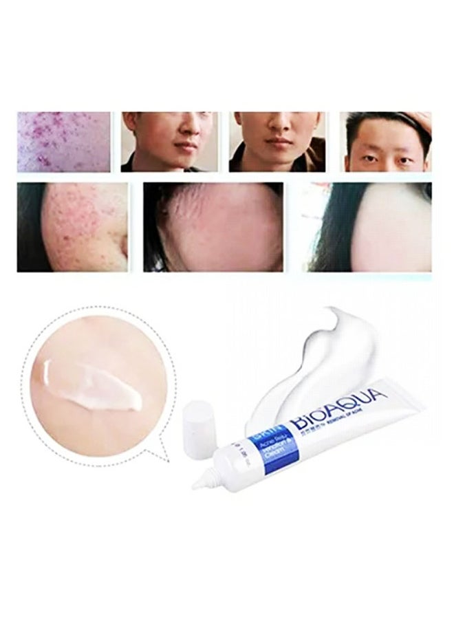 BIOAQUA Pure Skin Acne Treatment Scar Removal Cream 30grams  - Image 3