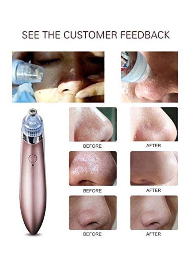 BOOBEAUTY Electric Blackhead Acne Pore Cleaner Pink  - Image 5