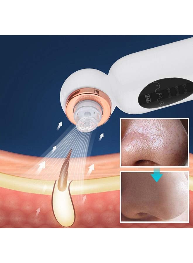 Toshionics - Vaccum Suction Blackhead Facial Pore Remover Cleanser Acne Comedo Extractor White - Image 1