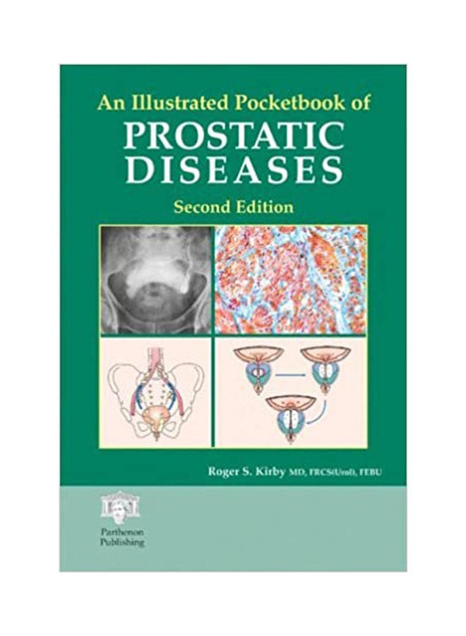 An Illustrated Pocketbook of Prostatic Diseases . Paperback English by Kirby - 2002