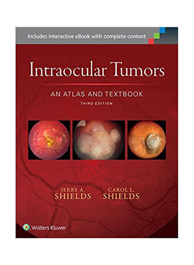 Atlas of Intraocular Tumors paperback english - 1999.0 