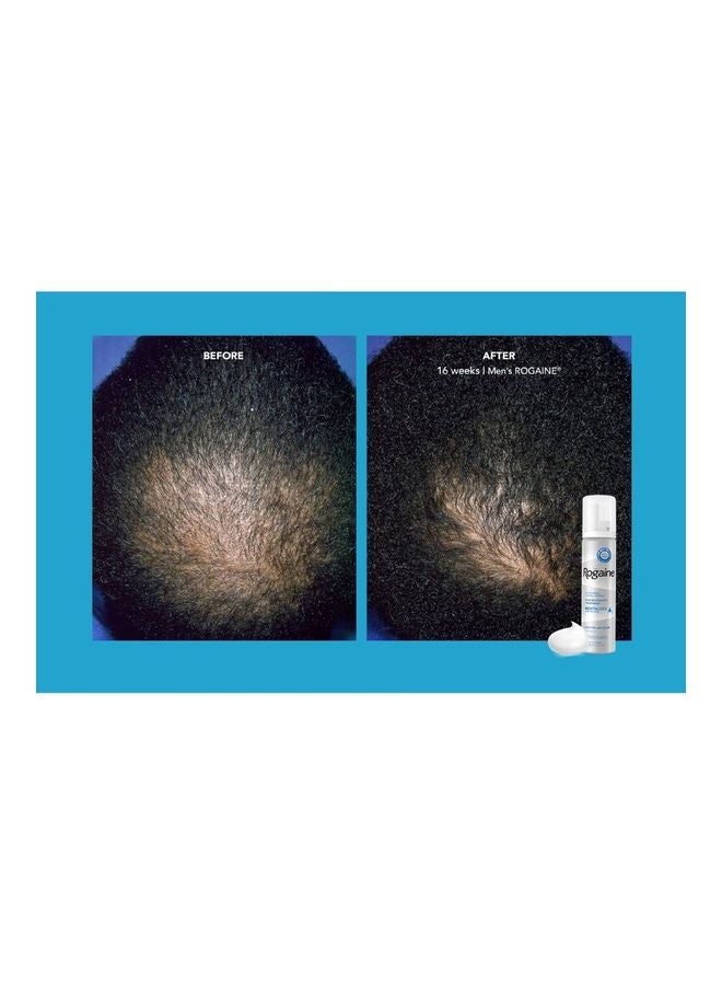 Rogaine - Minoxidil Foam For Hair Loss And Regrowth Topical Treatment 60grams - Image 1