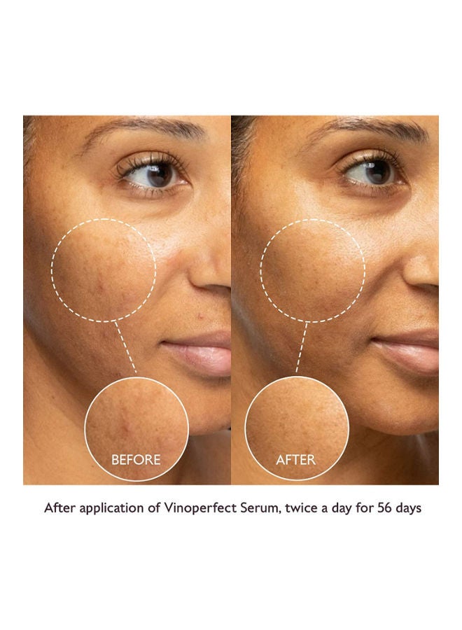 CAUDALIE Exclusive Vinoperfect Spring Set 110ml  - Image 3