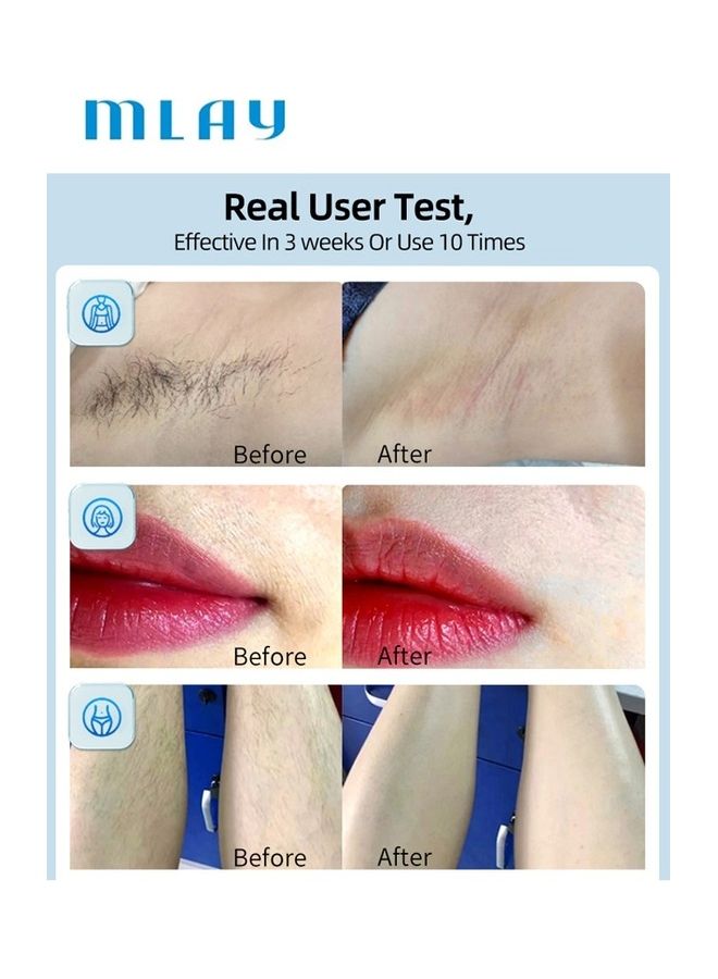 MLAY 3 In 1 Painless Ice Compress Hair Removal Device Multicolour  - Image 3