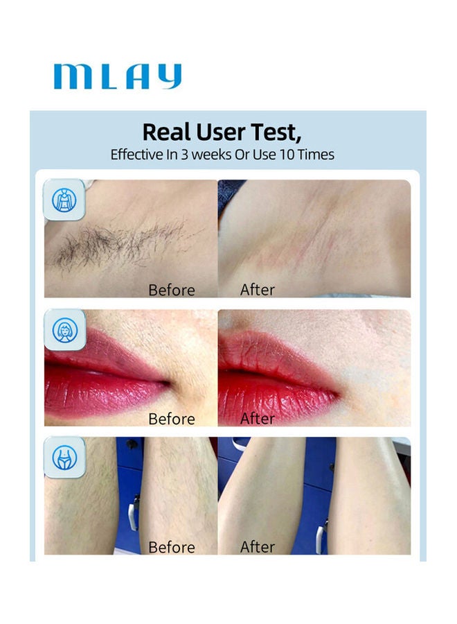 MLAY Updated T14 IPL Ice Laser Painless Hair Removal Device Bikini Lamp With A Gift Blackhead Remover 500000 Pulses 5 Levels Sky Blue - Image 4
