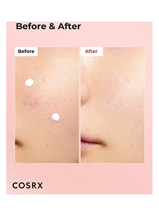 غسول تجفيف البقع حب الشباب - Image 2