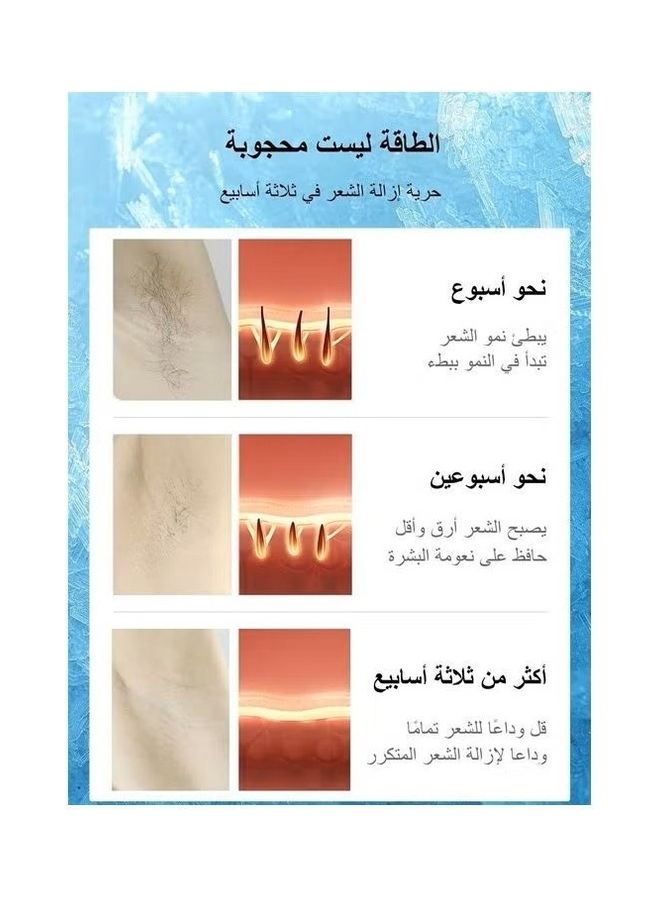 ملاي - أحدث جهاز لإزالة الشعر بالليزر T14 سريع وغير مؤلم 3 درجات ضغط بارد 5 مستويات 500000 نبضة - Image 1