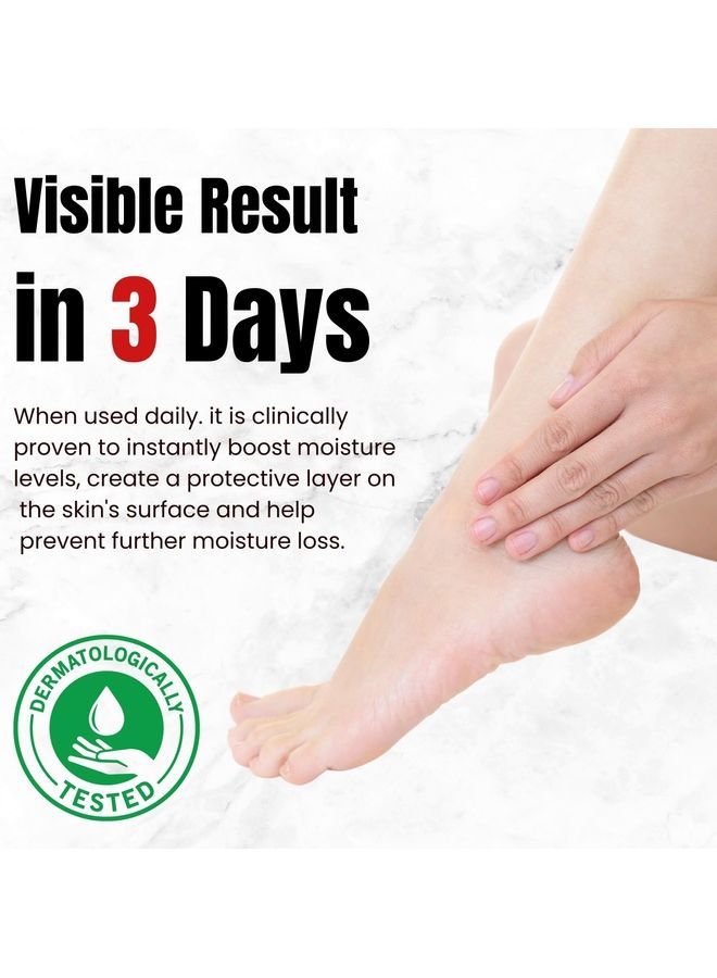 دكتور دافي كريم إصلاح أقدام عرق السوس للأقدام الجافة والمتشققة نتائج مرئية خلال 3 أيام يهدئ الالتهاب ويرطب وينعم ويعيد الراحة - Image 3