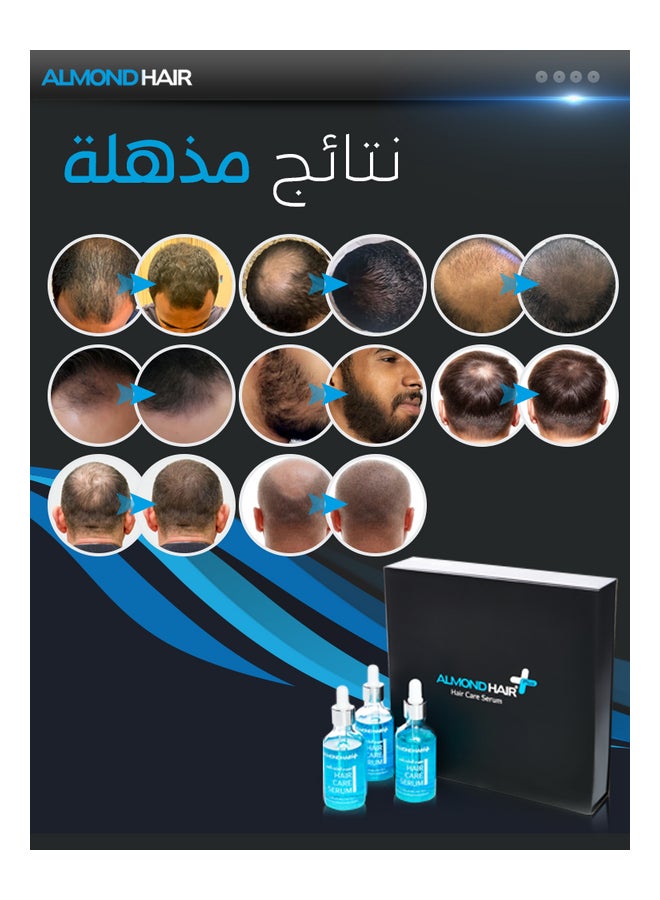 مجموعة نمو الشعر من 3 قطع أزرق 150ملليلتر