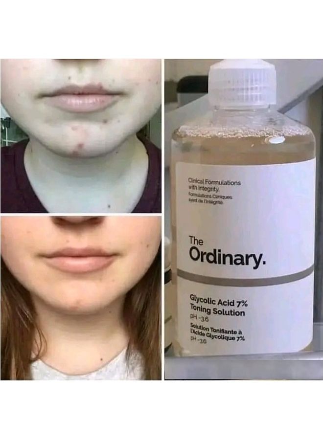 The Ordinary - Original Glycolic Acid 7 Percent Toning Solution Clear 240ml - Image 1