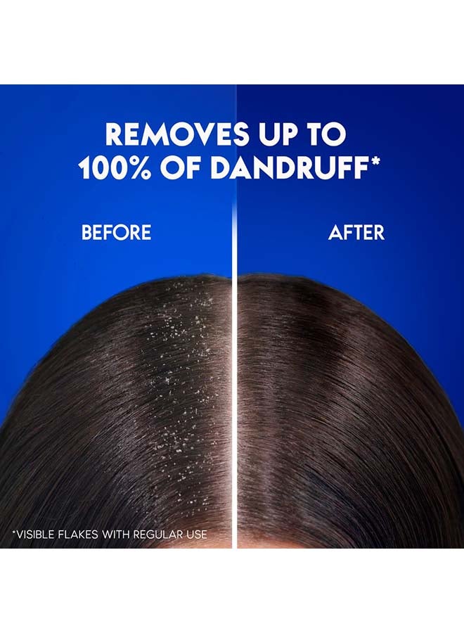 Head & Shoulders - 2In1 Smooth And Silky Anti-Dandruff Shampoo And Conditioner For Dry And Frizzy Hair 900ml - Image 1