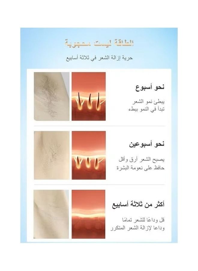 ملاي جهاز إزالة الشعر بالليزر الثلجي السريع وغير المؤلم (مع هدية مزيل الرؤوس السوداء) 500000 نبضة 5 مستويات - Image 5