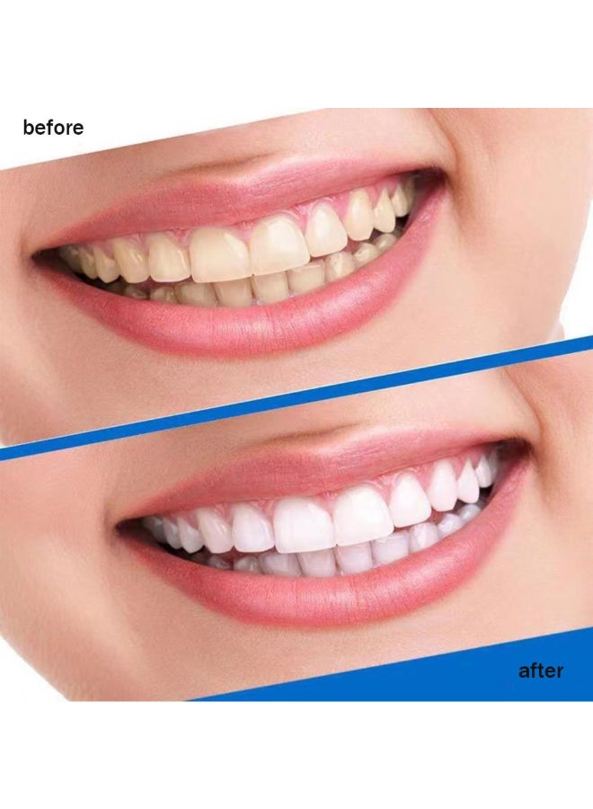 VILILY 14 Pairs 28 Piece 3D White Teeth Whitening Strip Dental Whitening Kit 100% Genuine Branded for Express Fast Result Treatments Professional Whitener Enamel & Stains Removal-Unisex 14grams  - Image 3
