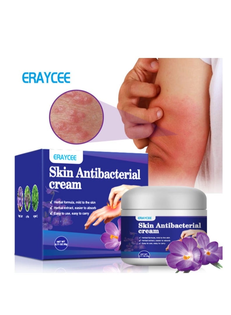 ERAYCEE Skin Antibacterial Anti Itch Cream, Bug Bite Itch Relief ...